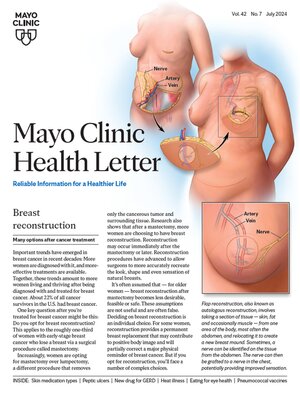 cover image of July 2024. Mayo Clinic Health Letter